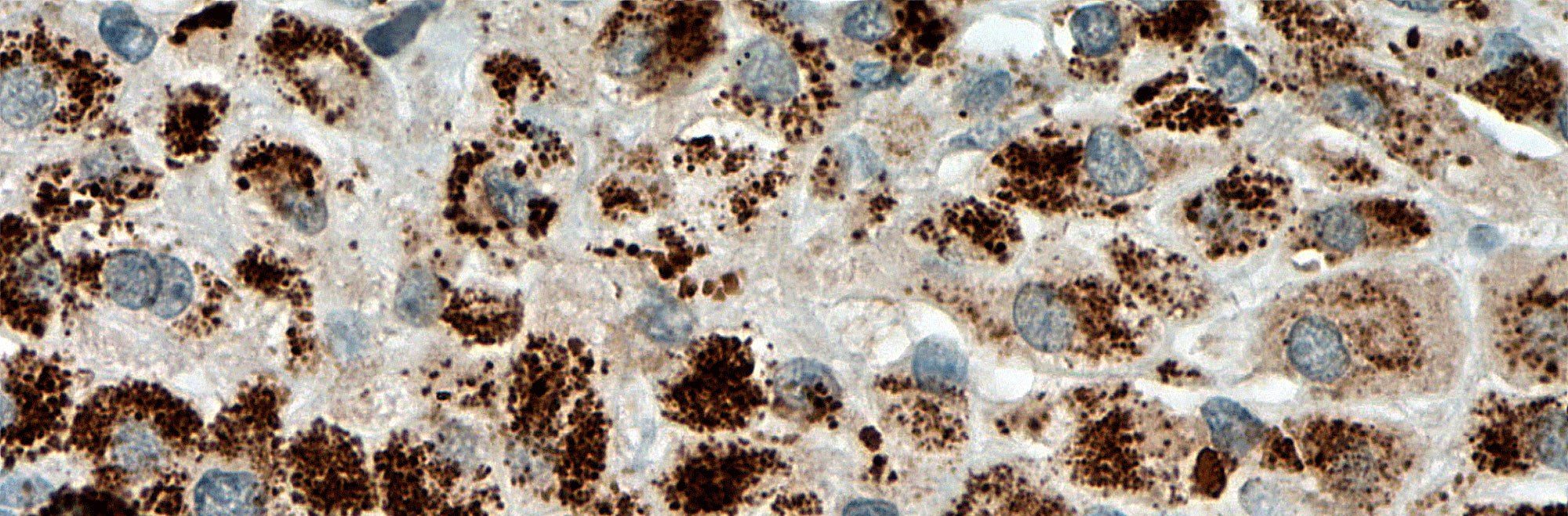 CYP11 B2