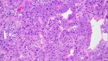 adrenal medulla - fig9