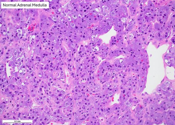 adrenal medulla - fig9