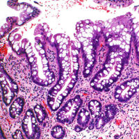 Barretts pathology slide