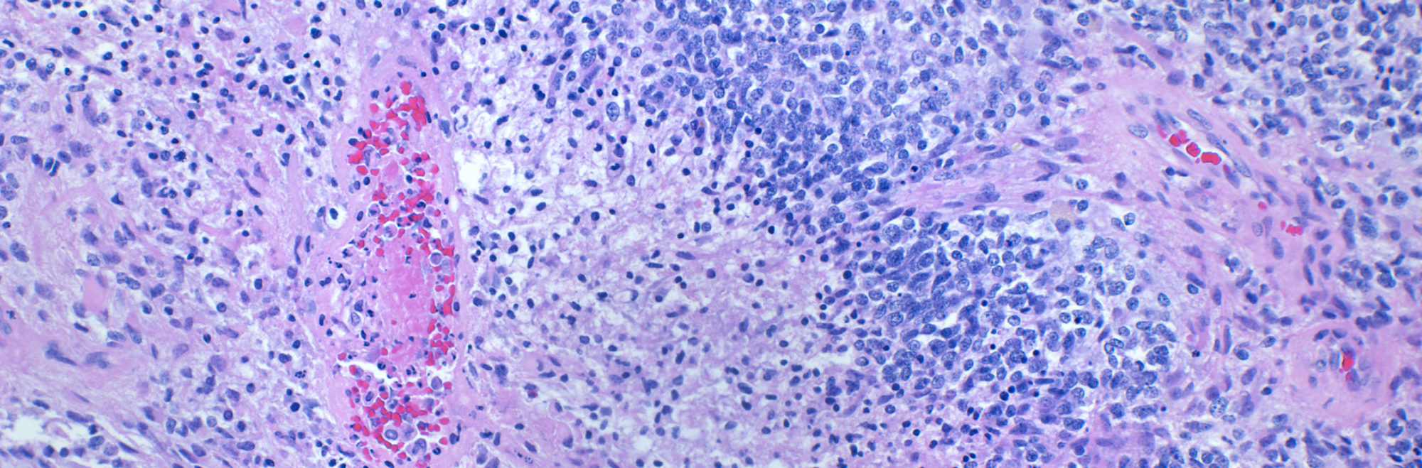 Pathology Slide (blue & pink)