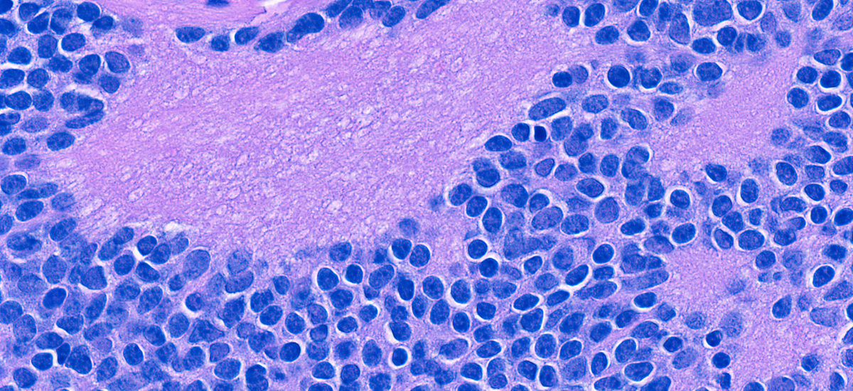 Pathology Slide (blue & purple)