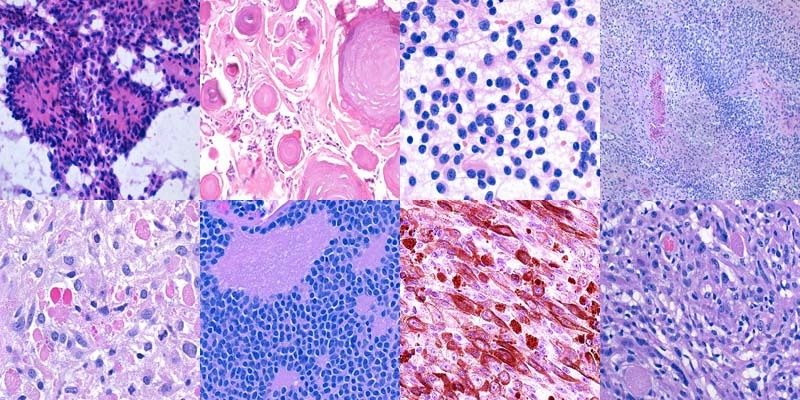 Collection of Pathology Slides