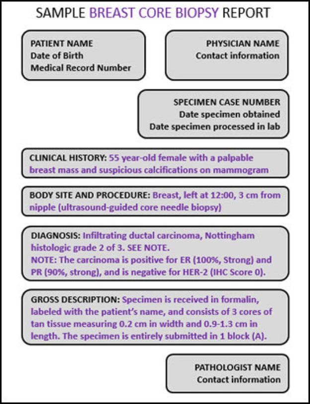 Sample Breast Core Biopsy Report