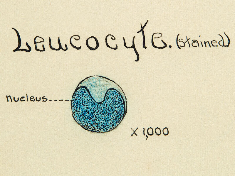 Arnold Rice Rich - Leucocyte illustration