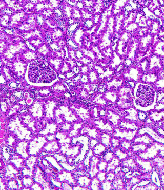 Home - Urologic Pathology Division | Johns Hopkins Pathology