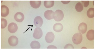 Peripheral blood smear microbiology