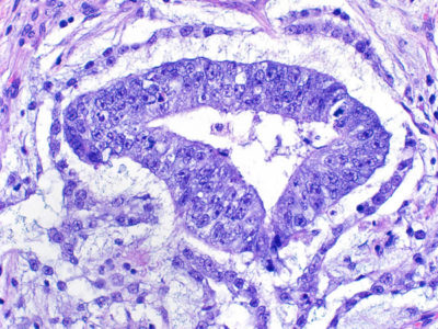 Surgical Pathology Unknown