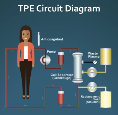 TPE cicrcuit diagram