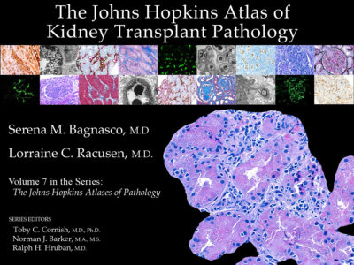 Atlas renal transplant