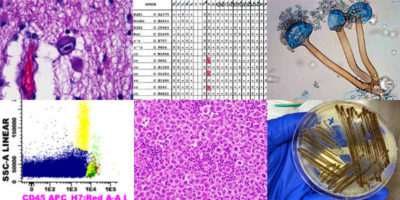 Clinical Pathology Unknowns collage
