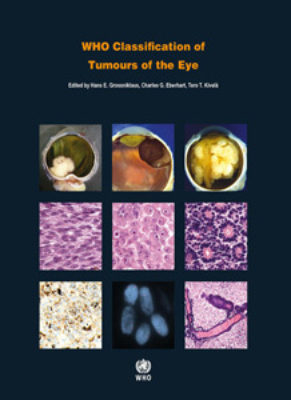 Eye book
