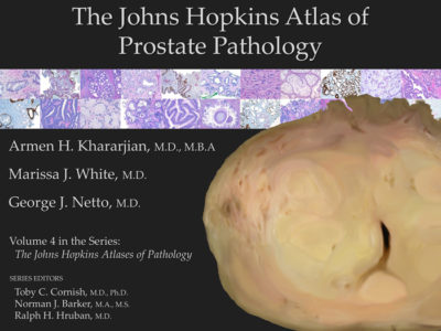 Prostate Pathology App