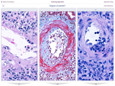 Atlas renal transplant screenshot 7