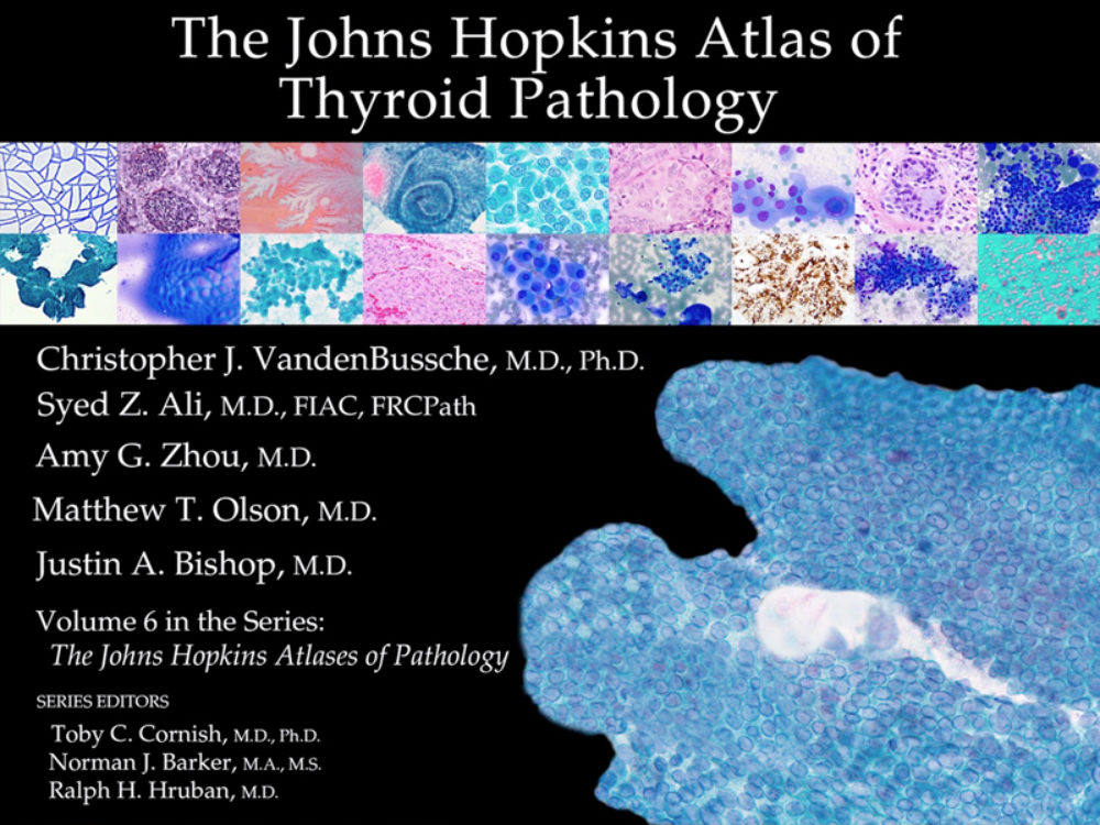 News | Johns Hopkins Pathology