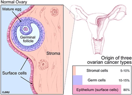 ovarian cancer lump pastile de pinworm ieftine