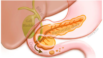 Pancreatic fluid