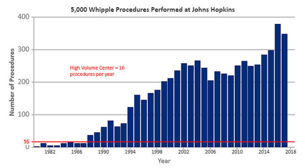 Whipple procedures graph