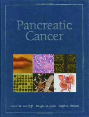 Pancreatic cancer book