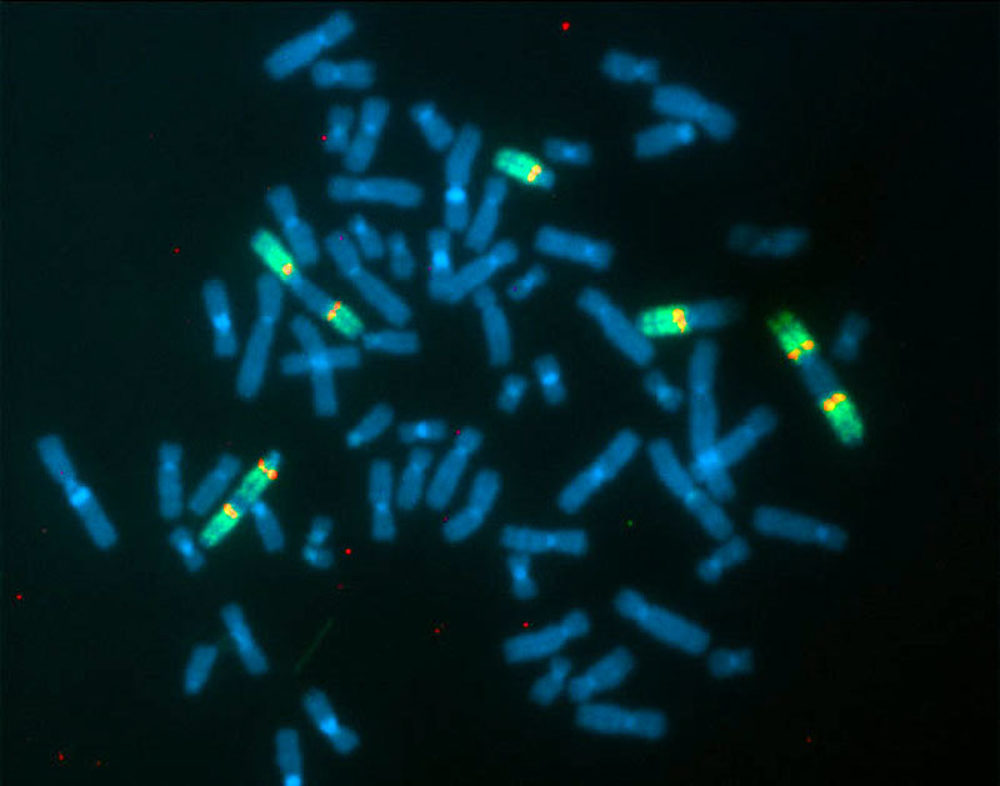 Fluorescent In-Situ Hybridization (FISH)