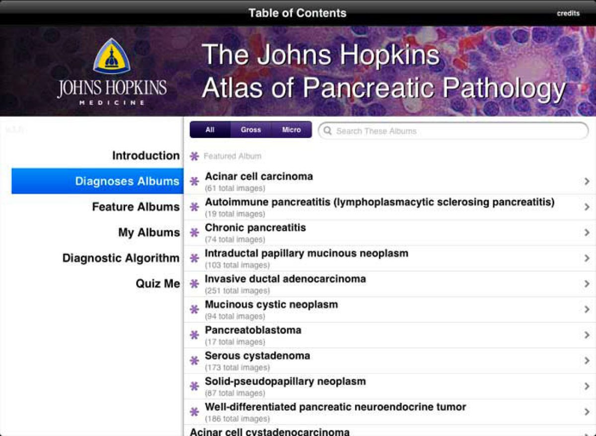 Pancreas ipad app screenshot