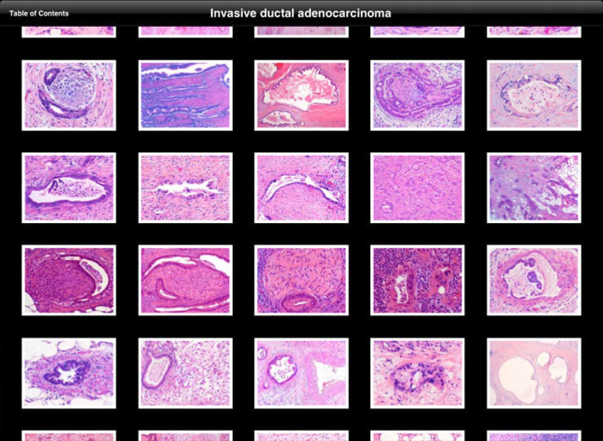 Pancreas ipad app screenshot