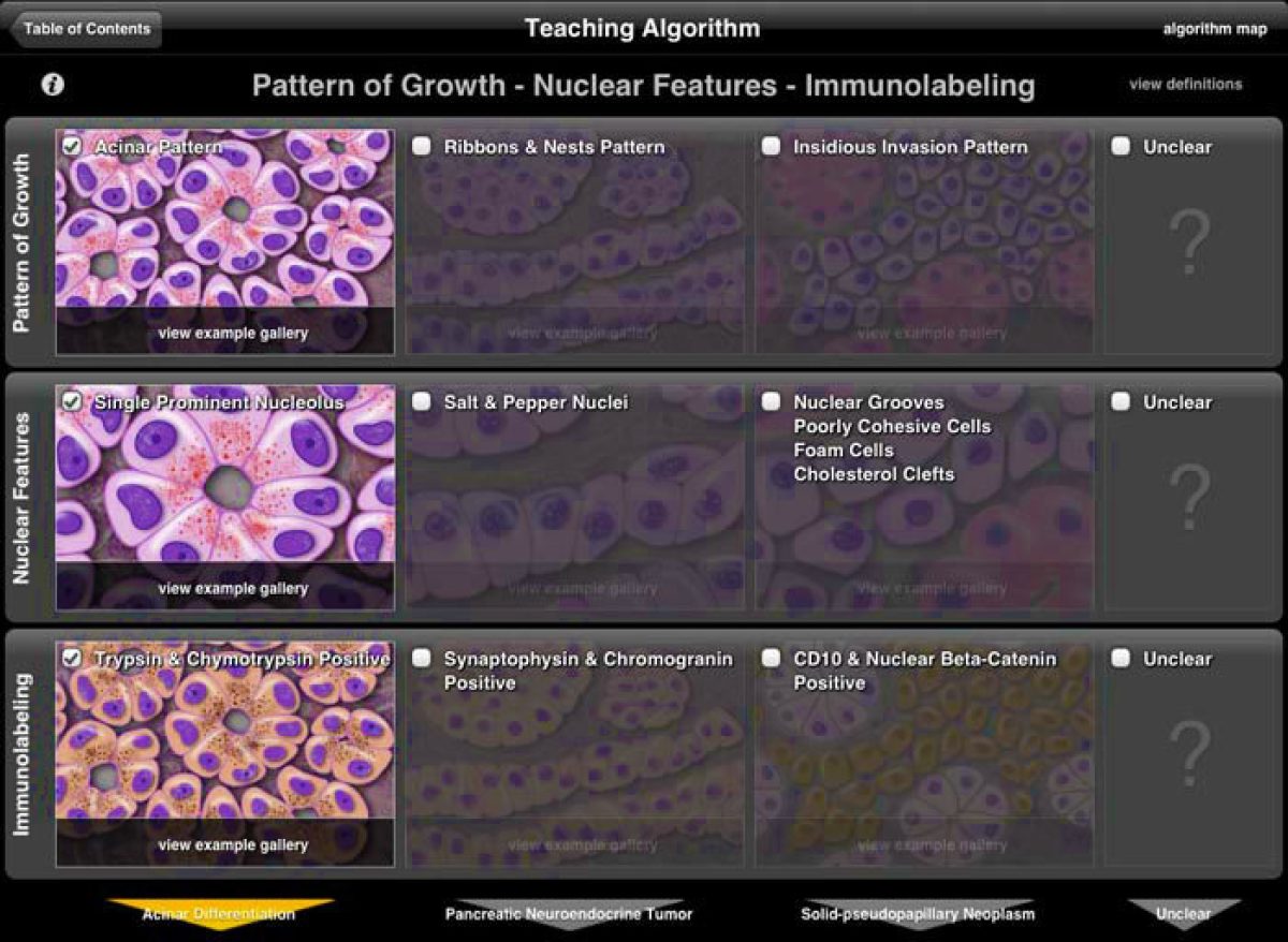 Pancreas ipad app screenshot