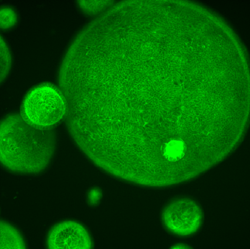 Apc mutant phalloidin