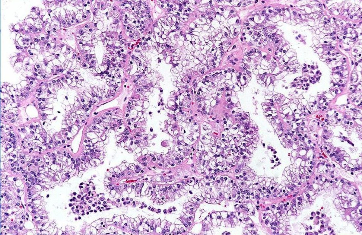 pathology slide