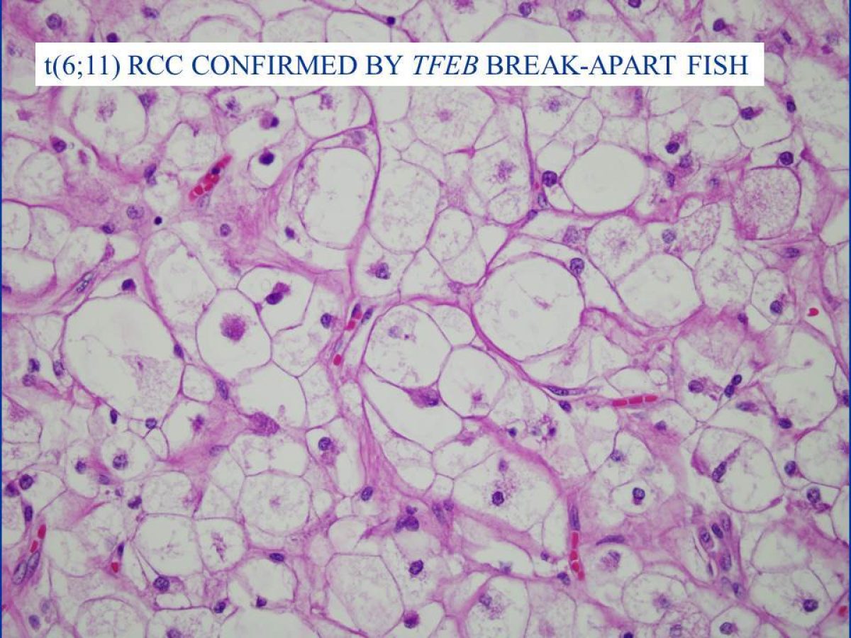 pathology slide