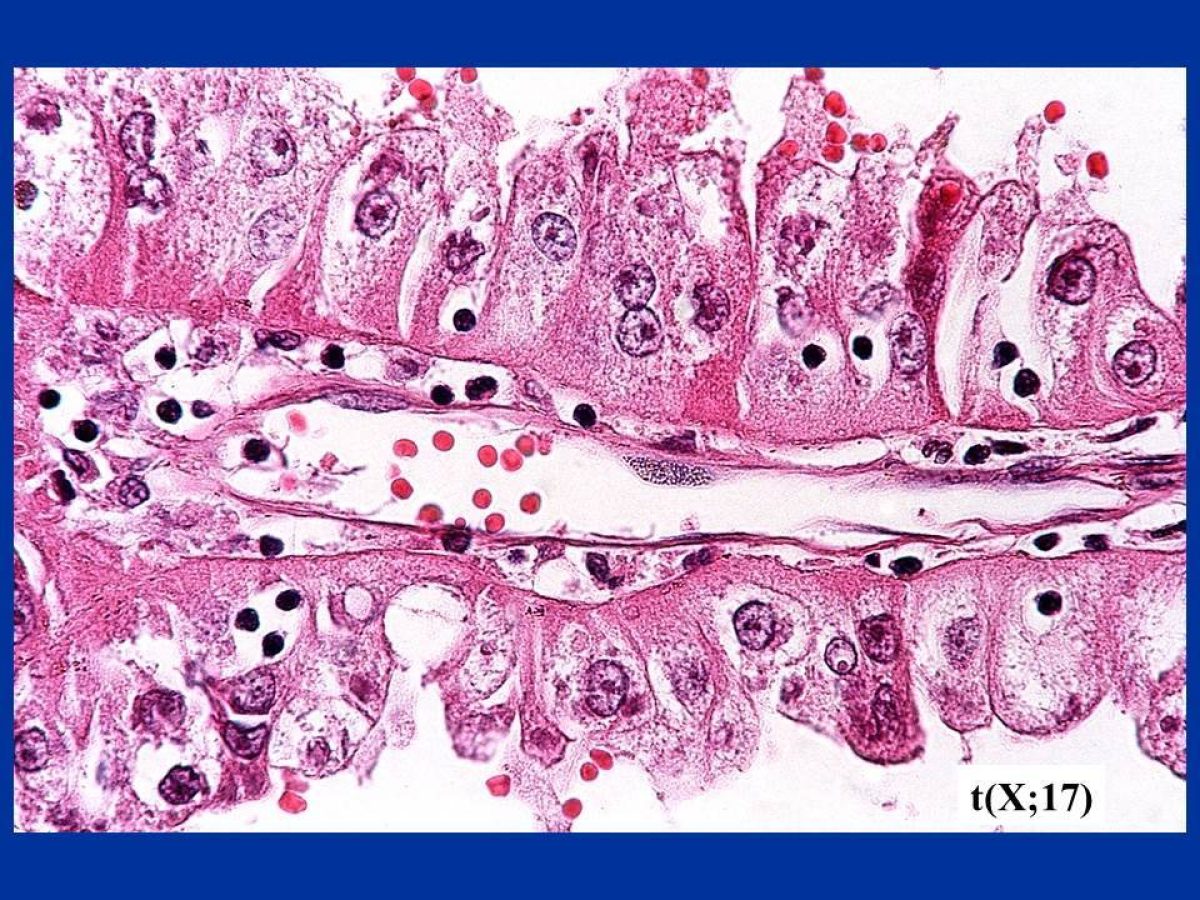 pathology slide