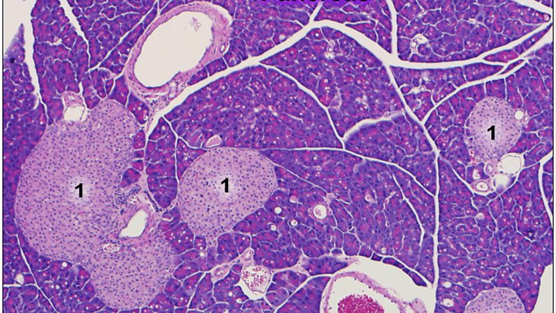 Pancreas Pathology Slide