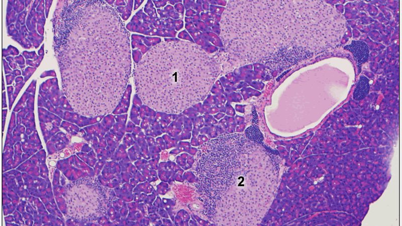 Pancreatic Pathology Slide