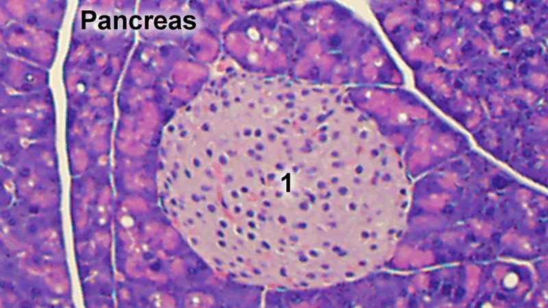 Pancreas Pathology Slide