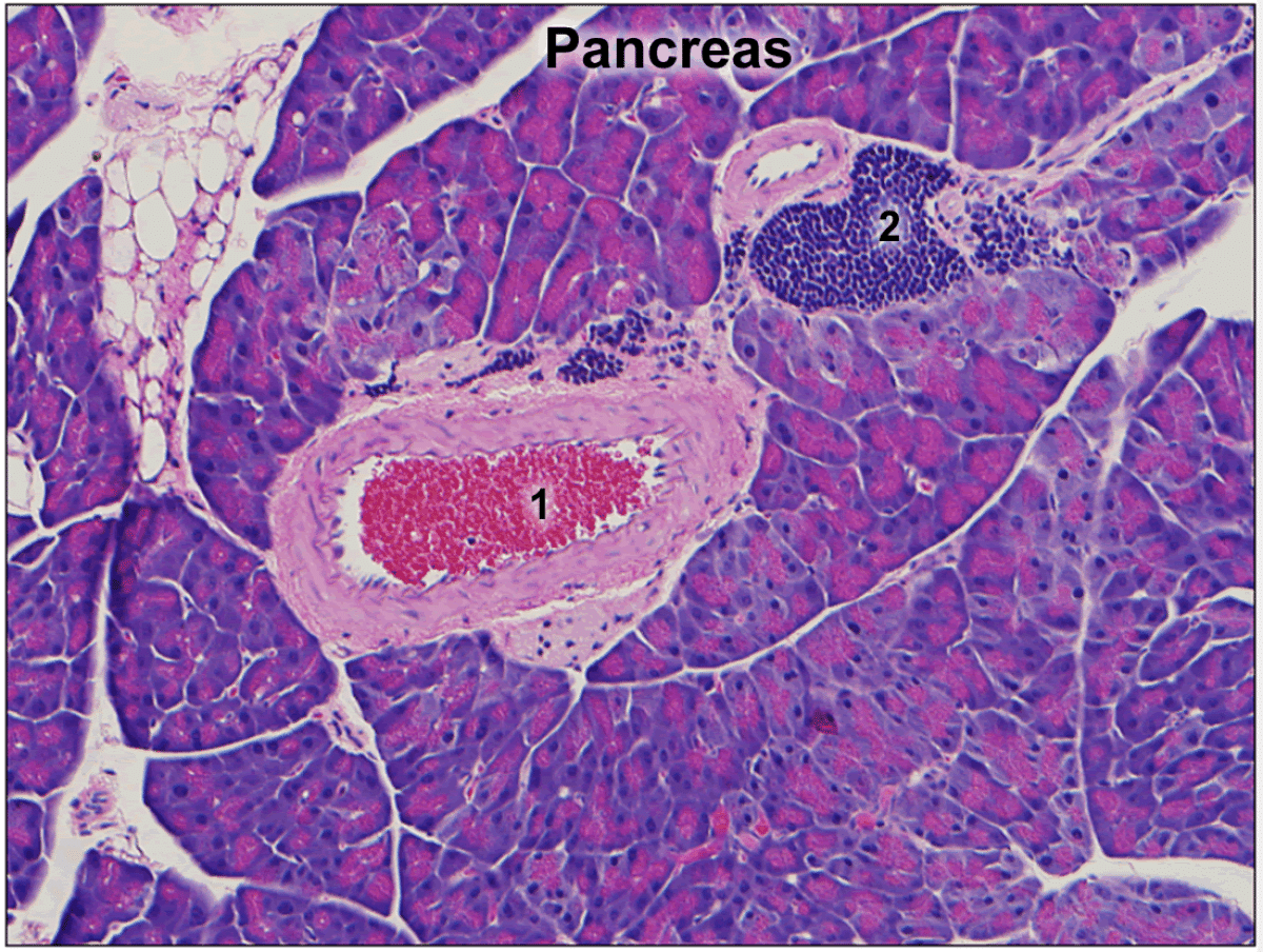 Pancreatic Pathology Slide