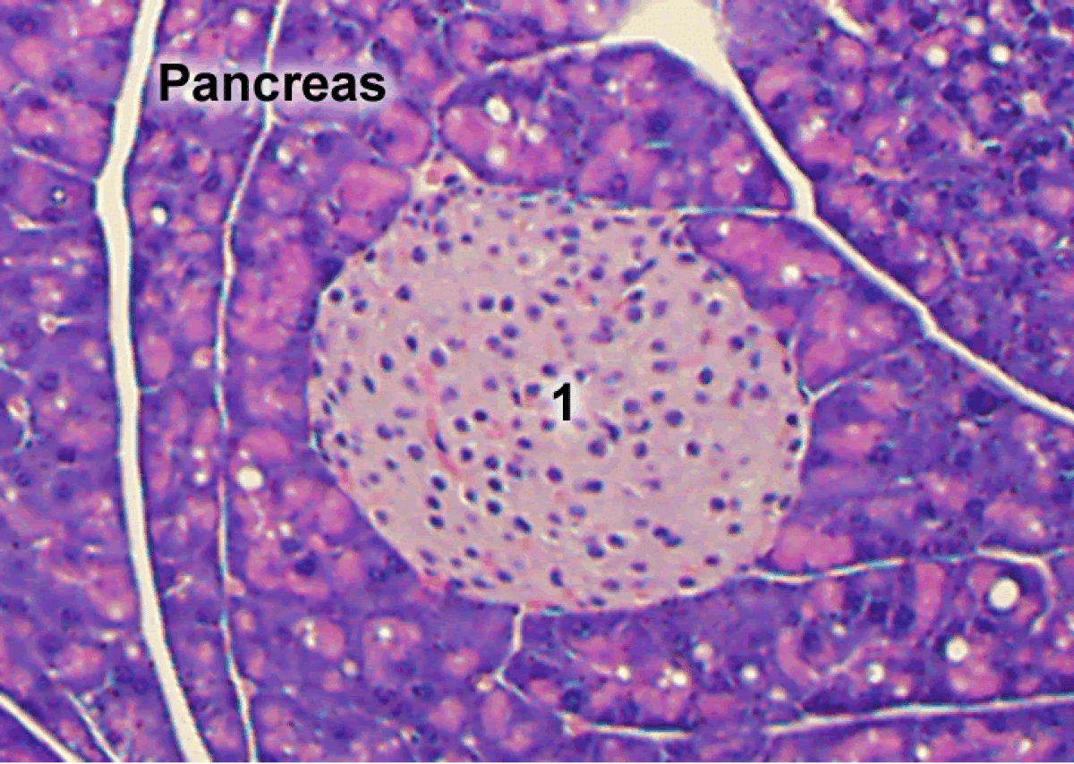 Pancreas Pathology Slide