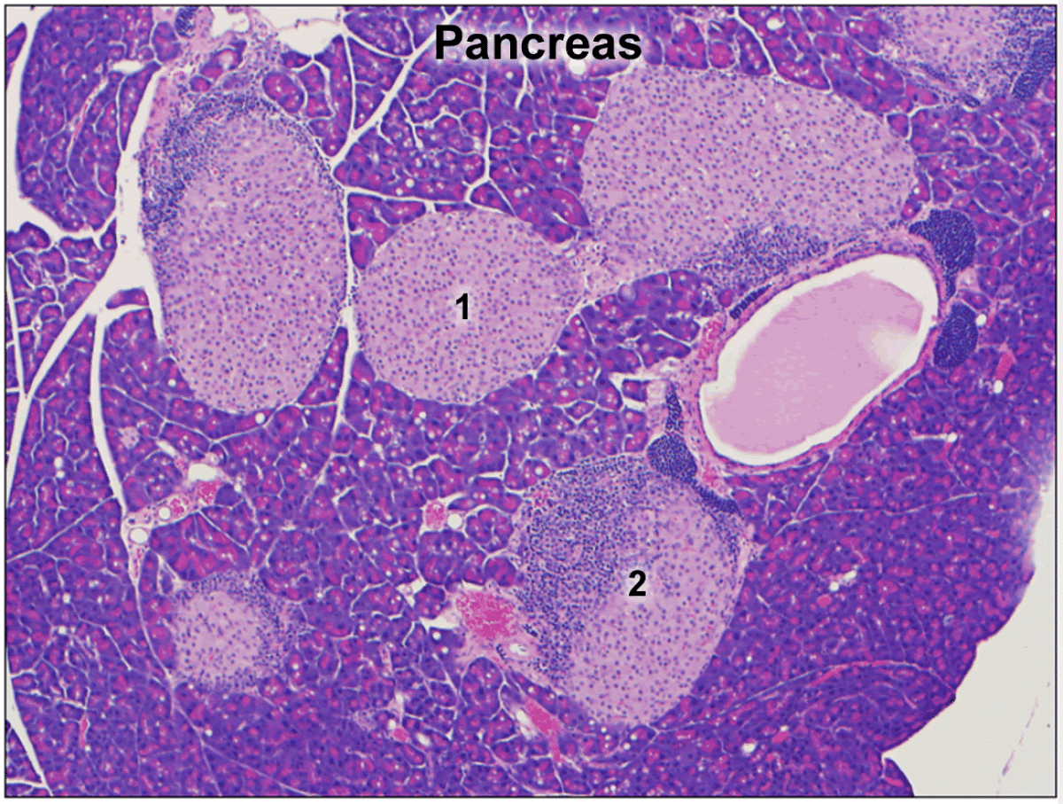 Pancreatic Pathology Slide