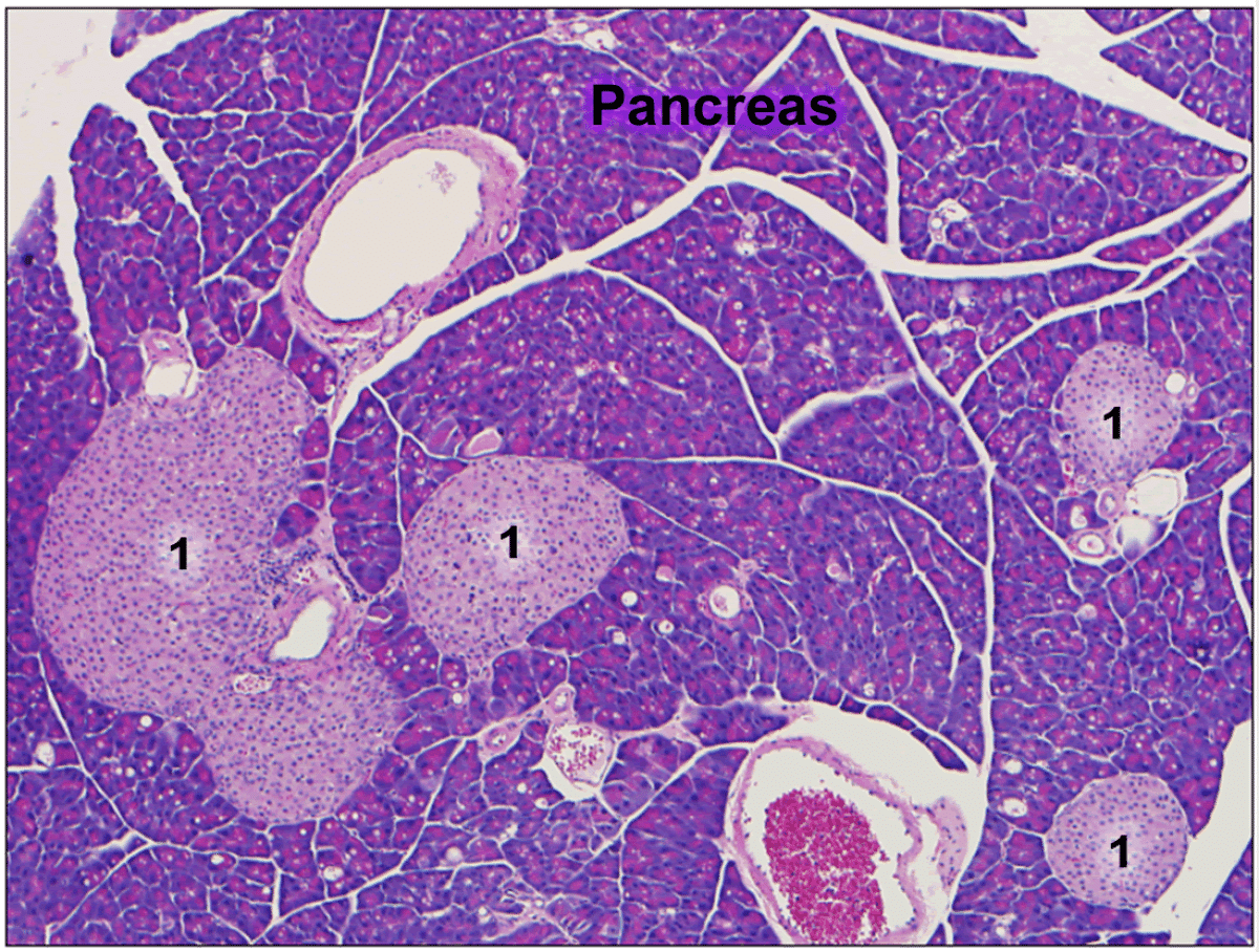 Pancreas Pathology Slide
